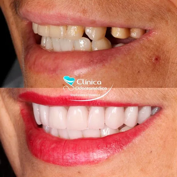 Caso Antes e Depois 7